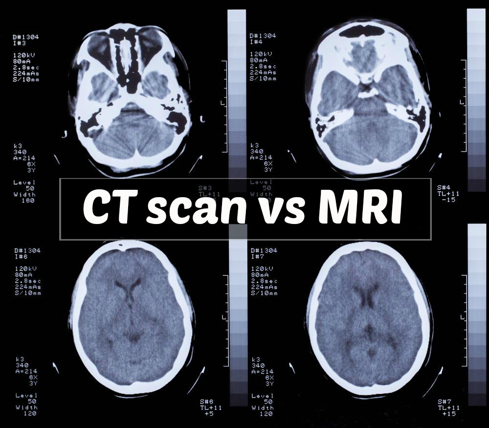 a scan vs c scan